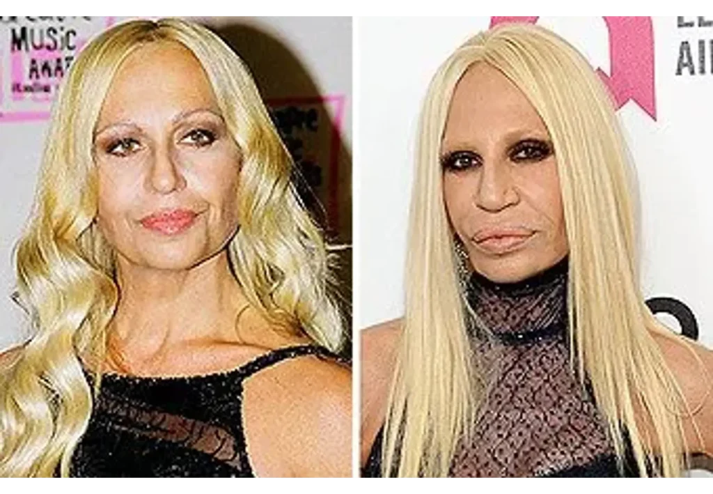 Донателла Версаче в молодости: как формировался культовый стиль и характер